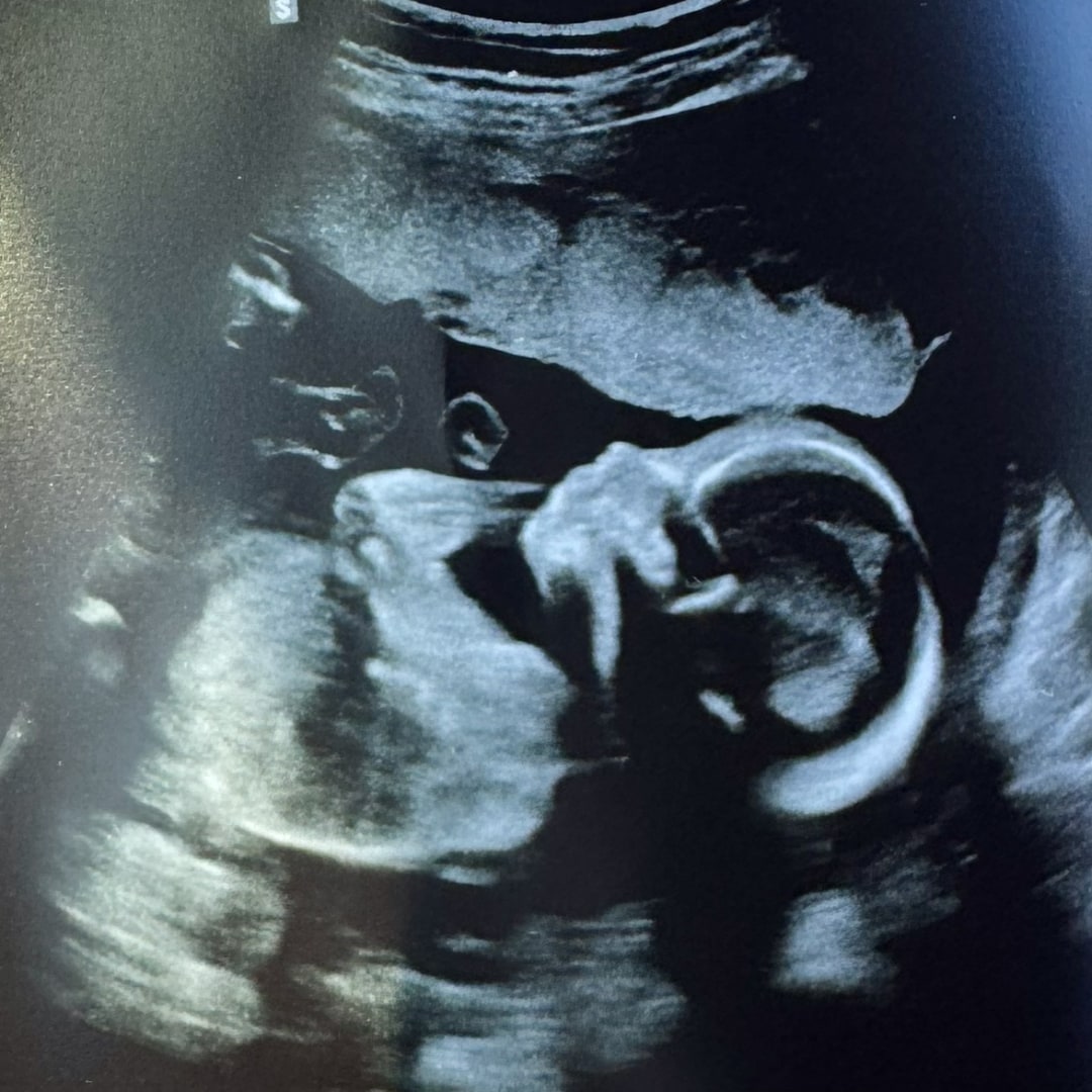 Photo shared by Carolyn for their Babylist baby registry.