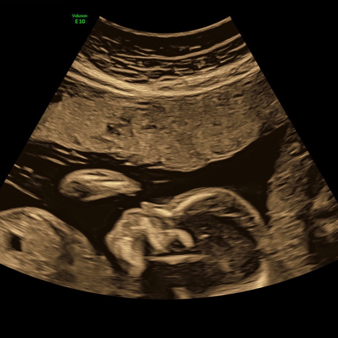 Photo shared by Courtney for their Babylist baby registry.