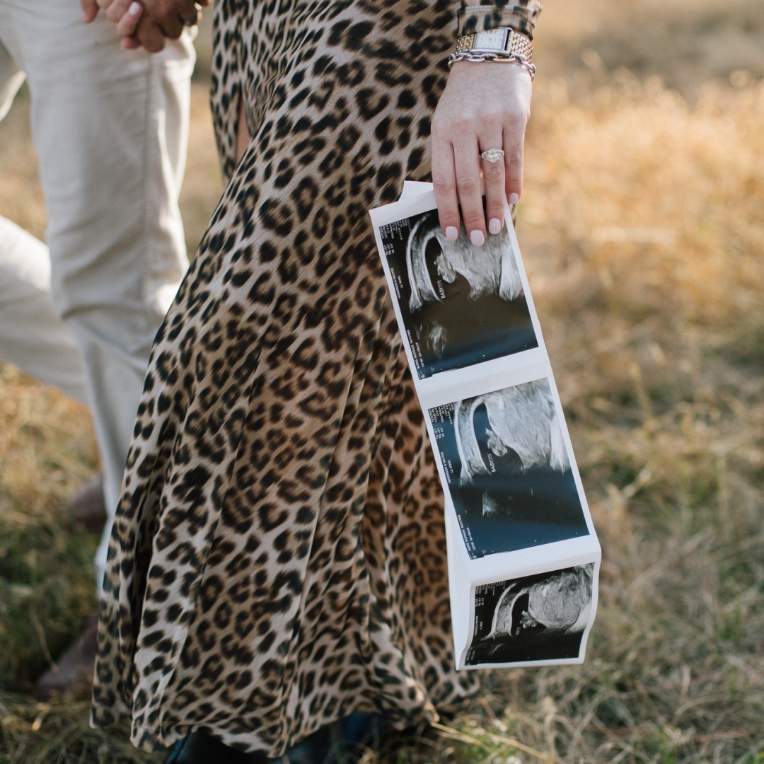 Photo shared by McKenzie for their Babylist baby registry.