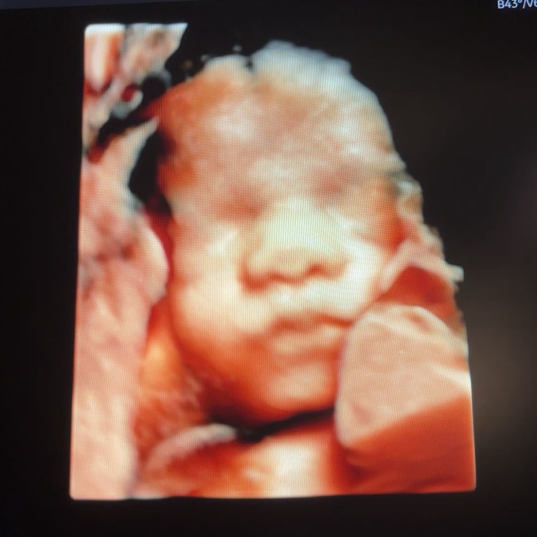 Photo shared by Emma for their Babylist baby registry.