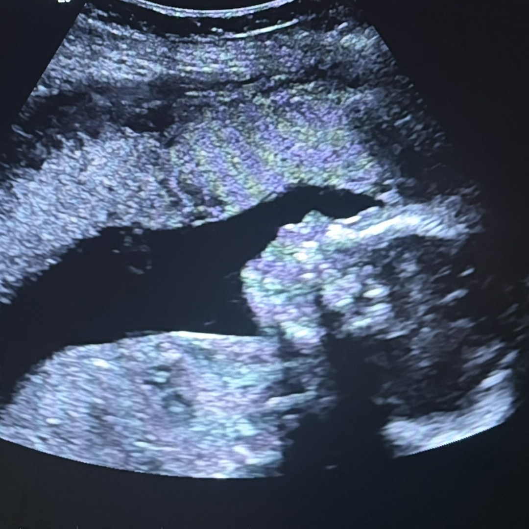 Photo shared by Kelly for their Babylist baby registry.