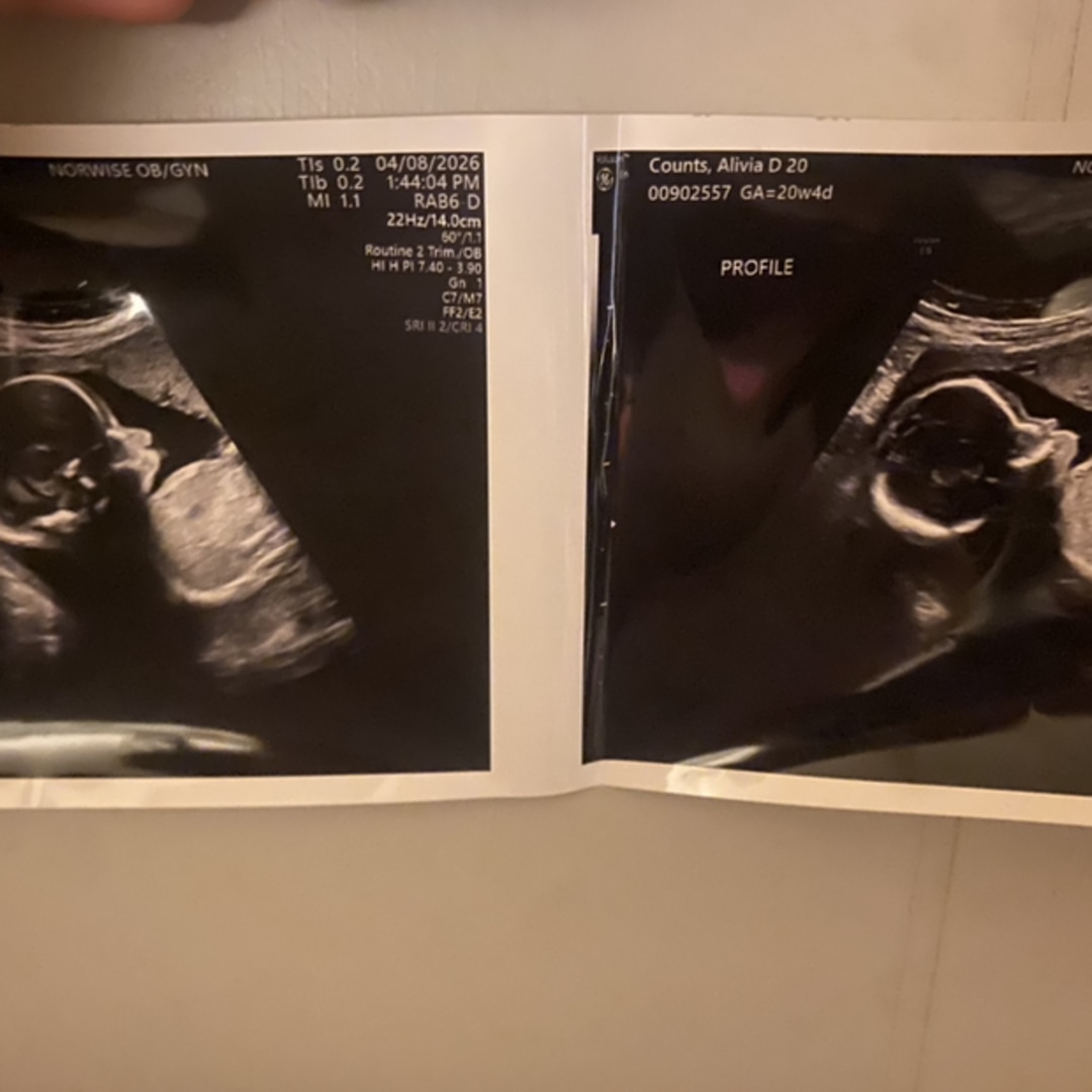 Photo shared by Alivia for their Babylist baby registry.