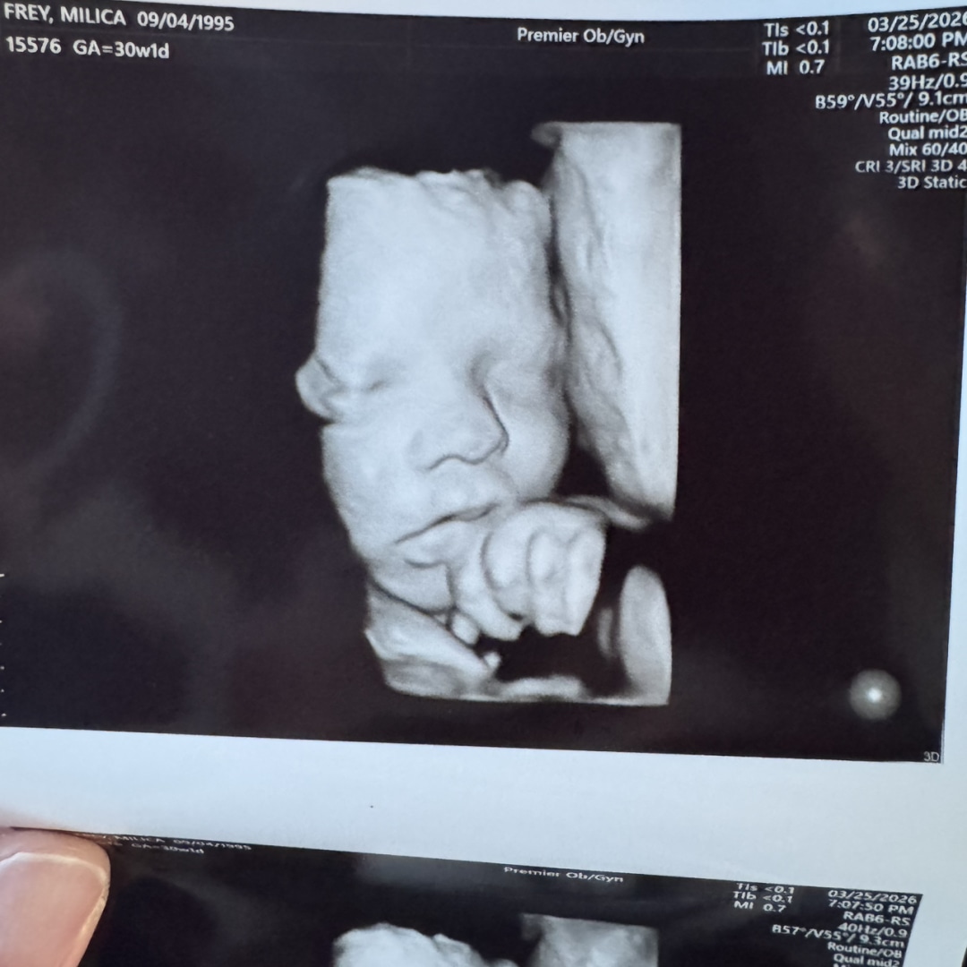 Photo shared by Milica for their Babylist baby registry.