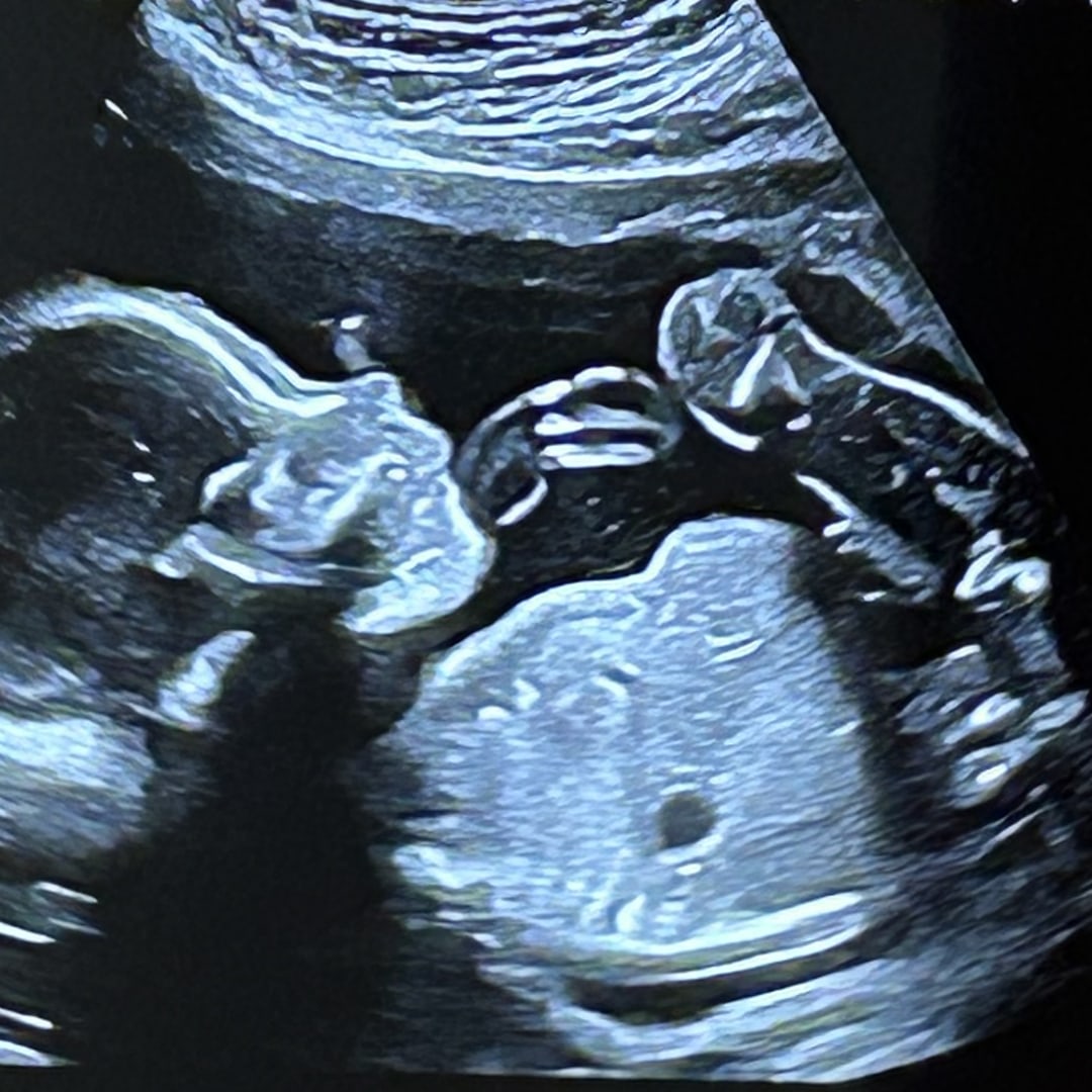 Photo shared by Cristina for their Babylist baby registry.