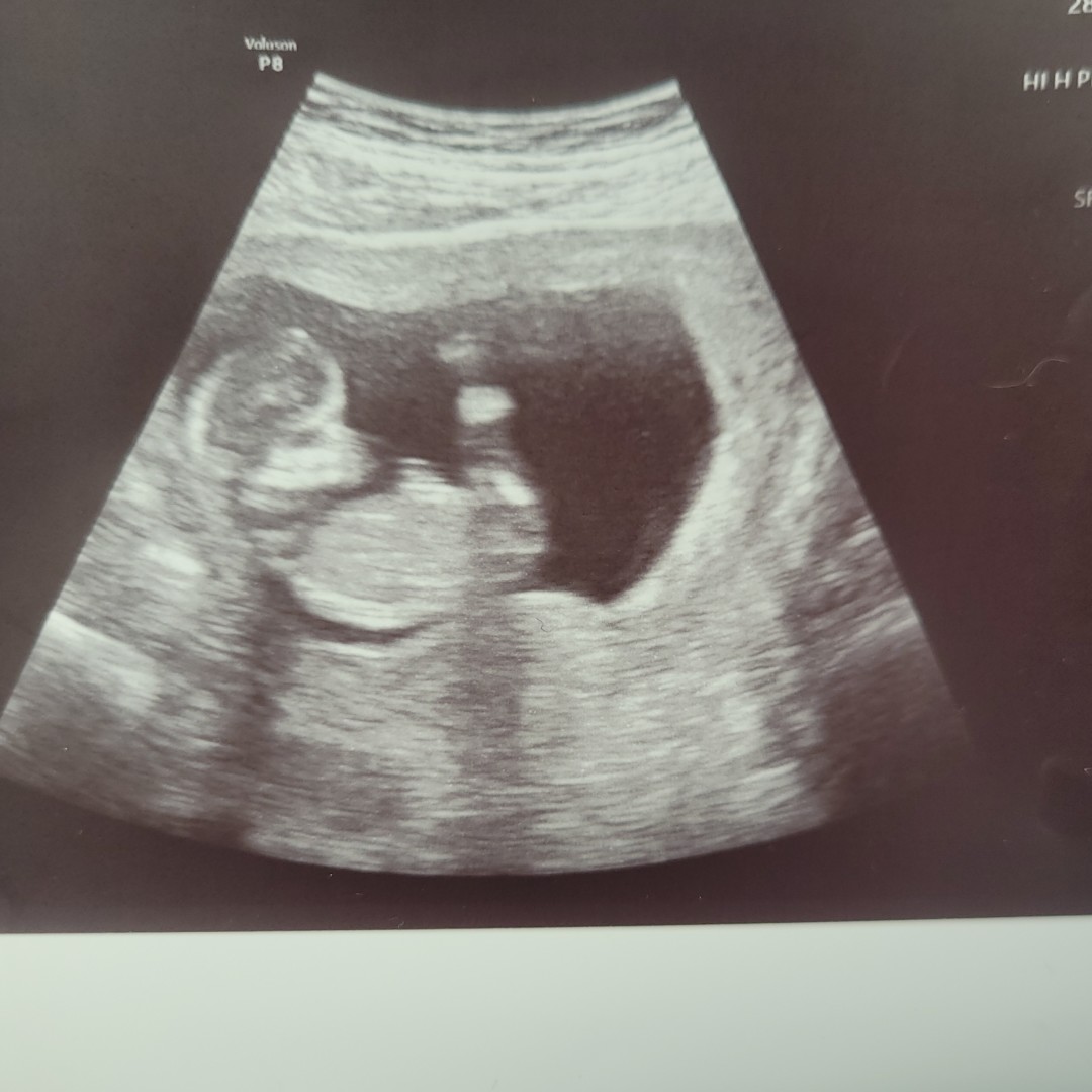 Photo shared by Ava for their Babylist baby registry.