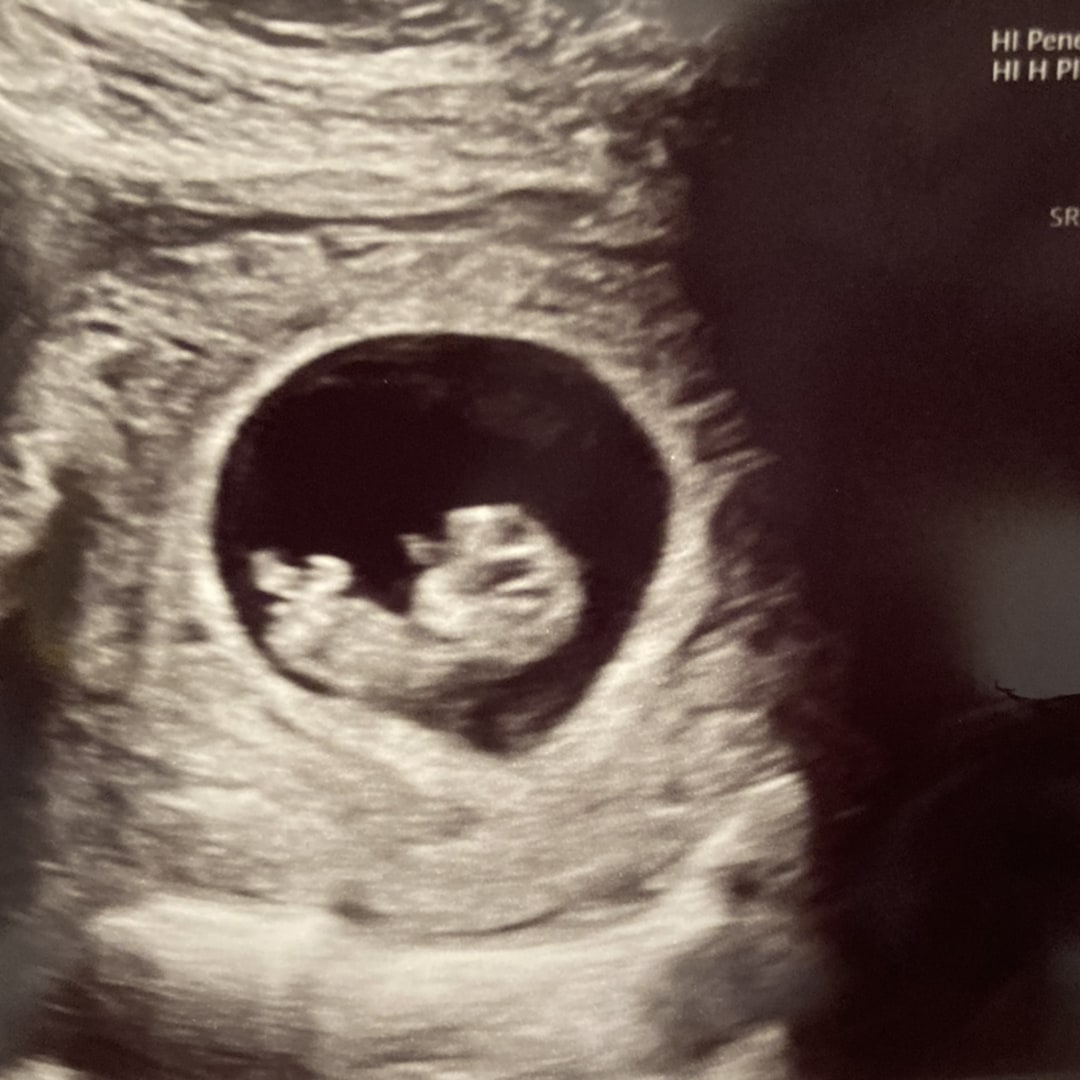 Photo shared by Meghan for their Babylist baby registry.