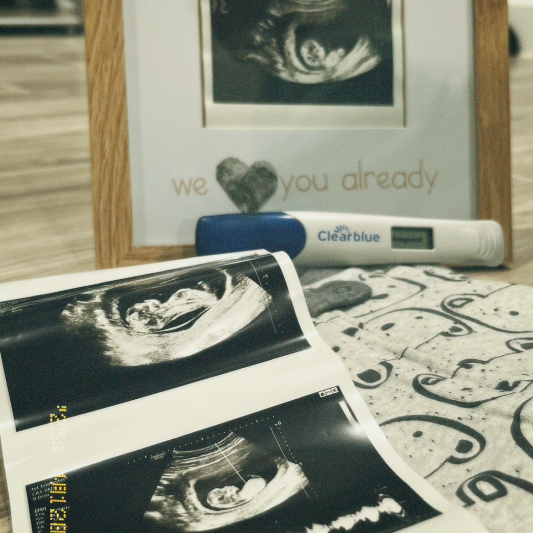 Photo shared by Alexa for their Babylist baby registry.