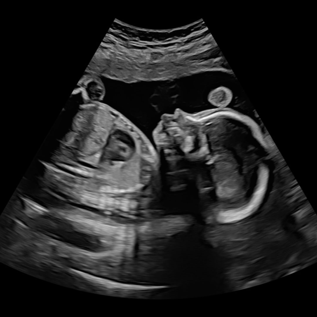 Photo shared by Joseph and Kylie for their Babylist baby registry.