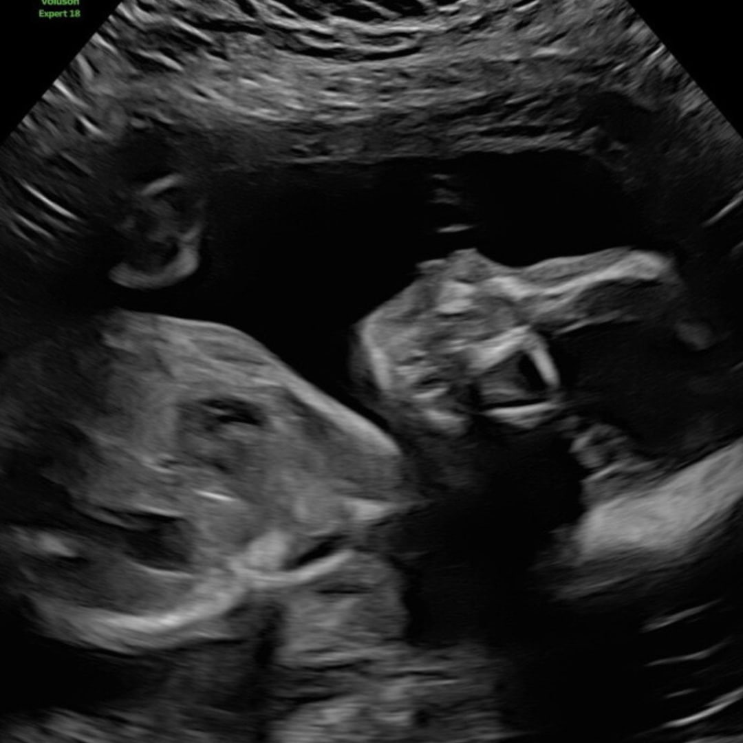 Photo shared by Ameyah for their Babylist baby registry.