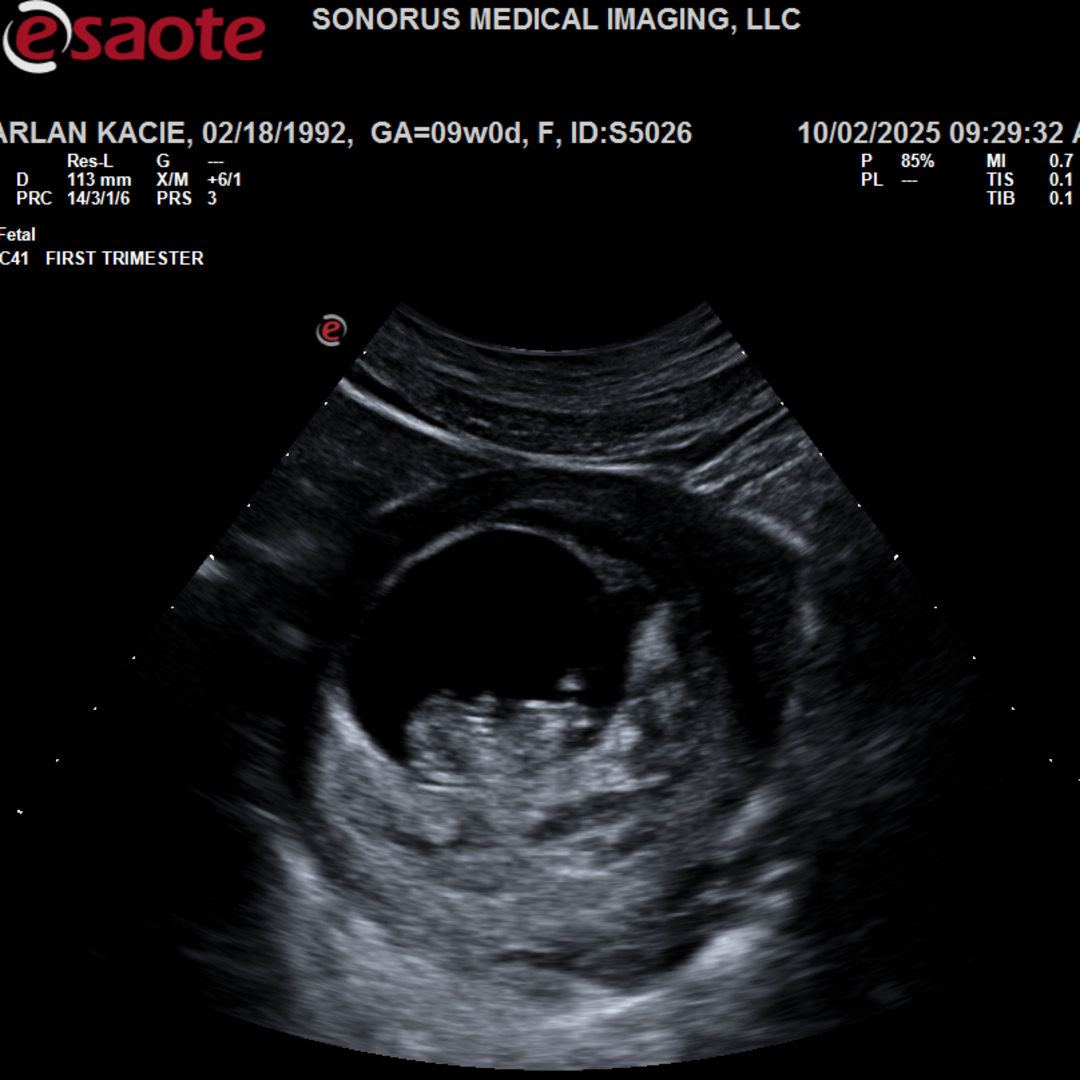 Photo shared by Kacie for their Babylist baby registry.