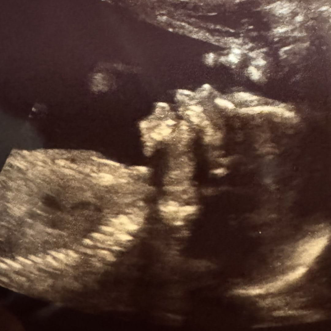 Photo shared by Dianne for their Babylist baby registry.