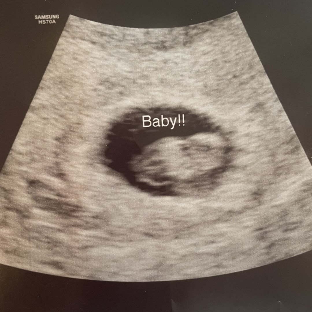 Photo shared by Rosie for their Babylist baby registry.