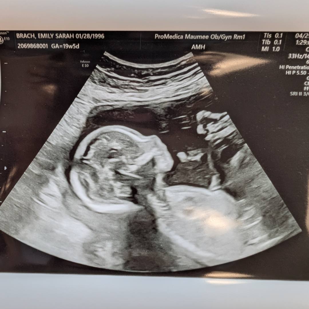 Photo shared by Emily for their Babylist baby registry.