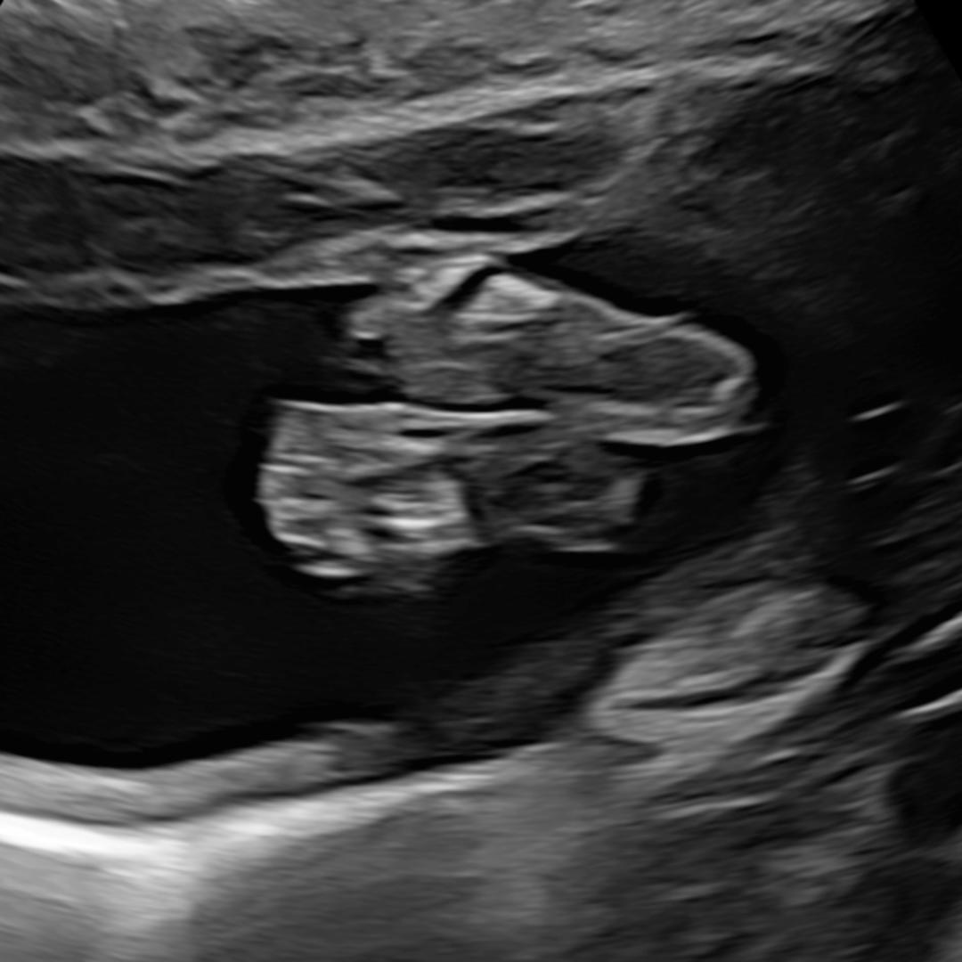 Photo shared by Jessica De for their Babylist baby registry.