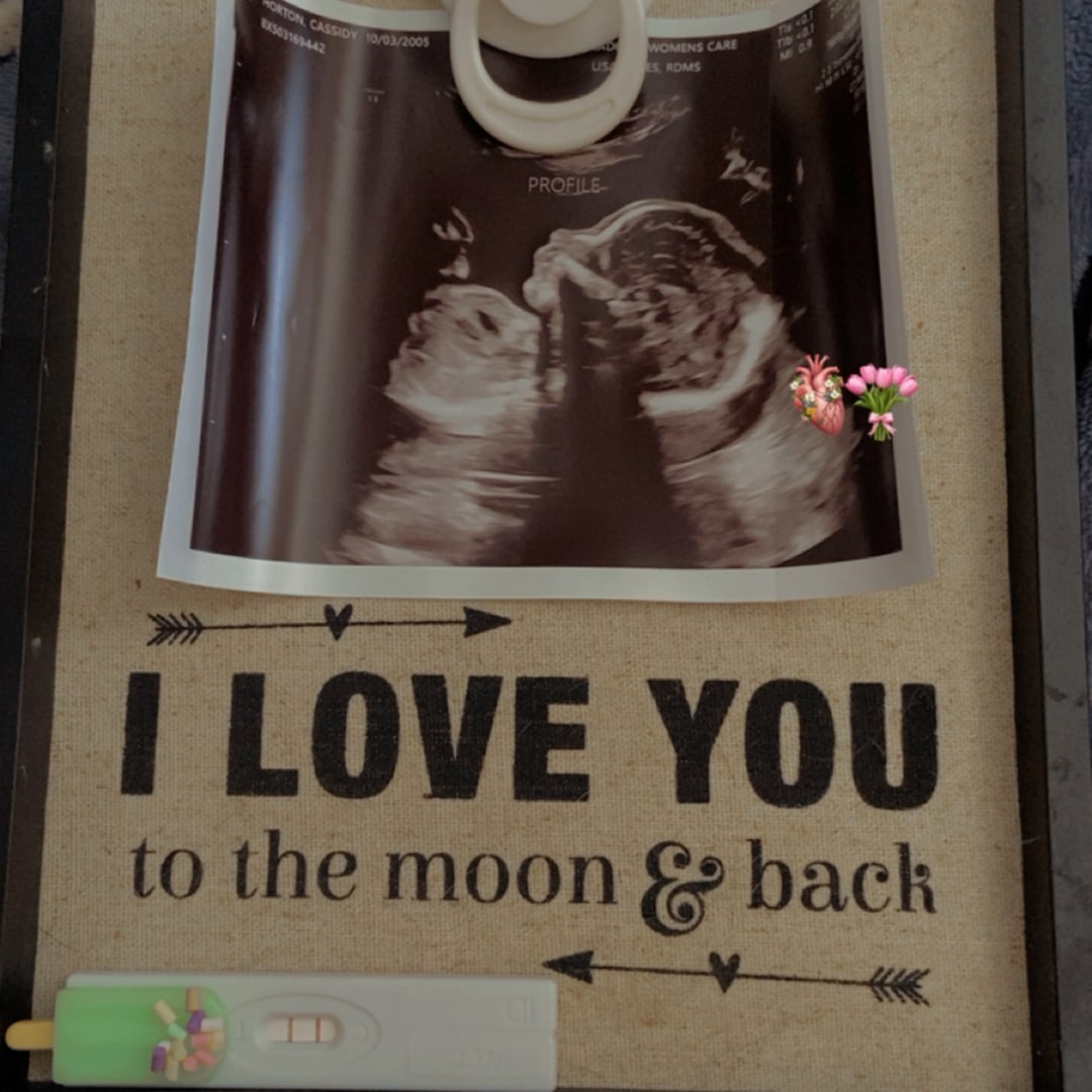 Photo shared by Cassidy for their Babylist baby registry.