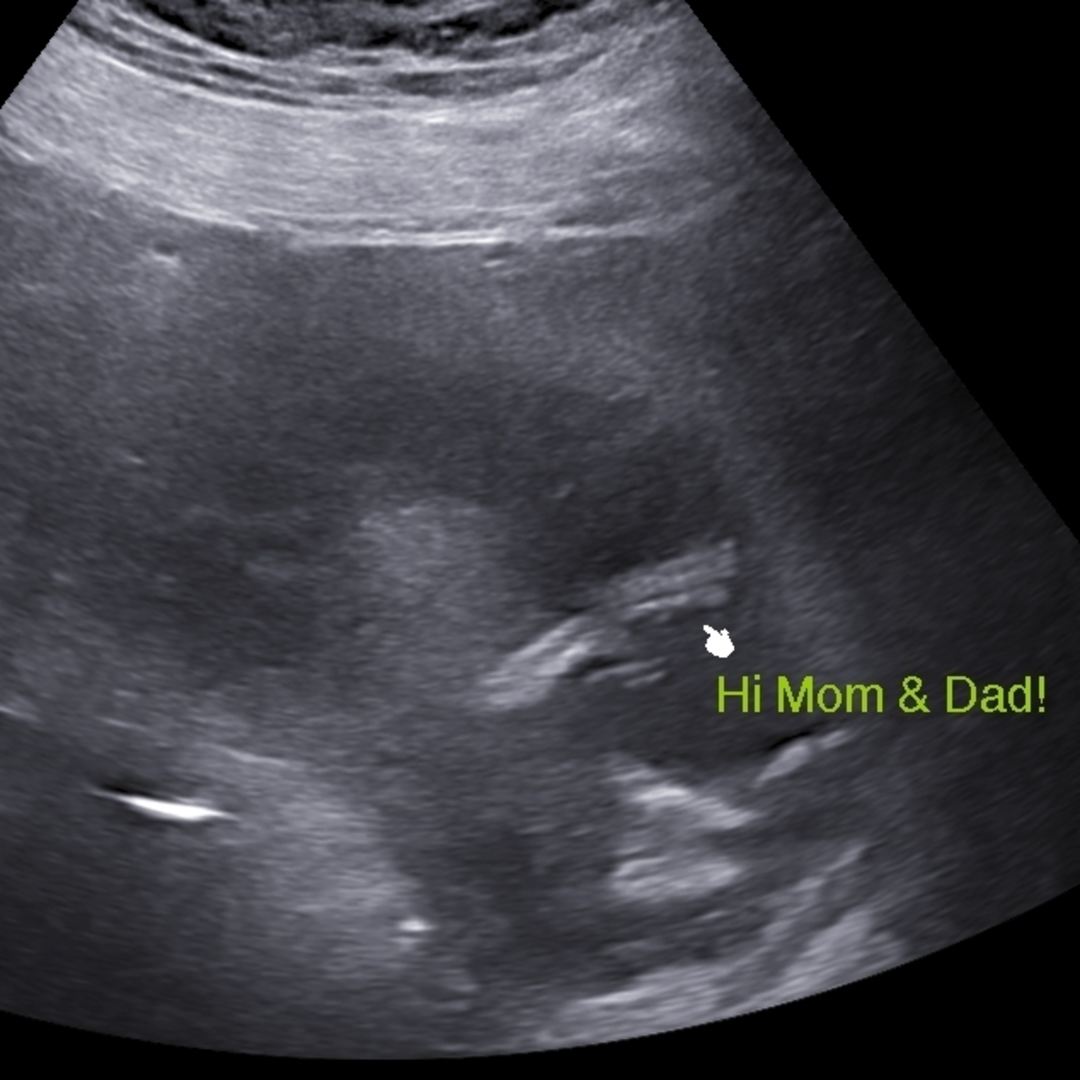 Photo shared by Ciara for their Babylist baby registry.