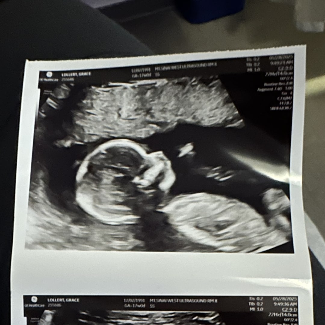 Photo shared by Grace for their Babylist baby registry.