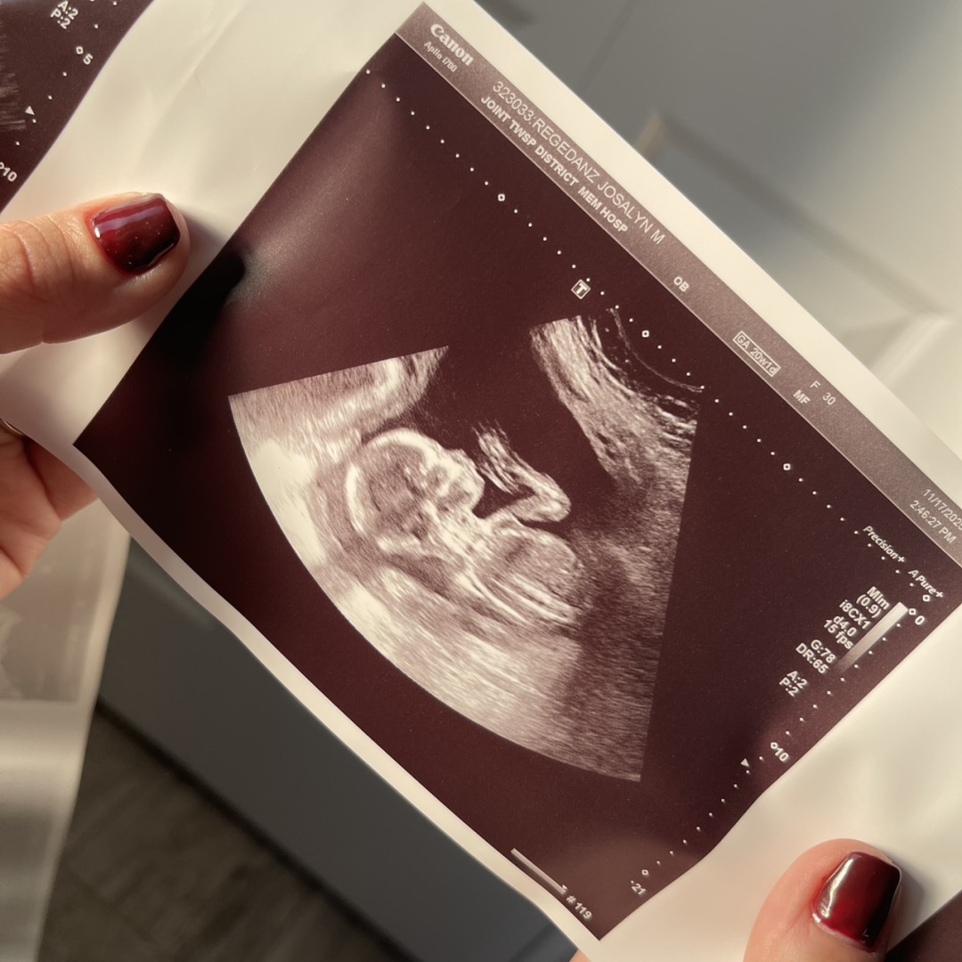 Photo shared by Josalyn for their Babylist baby registry.