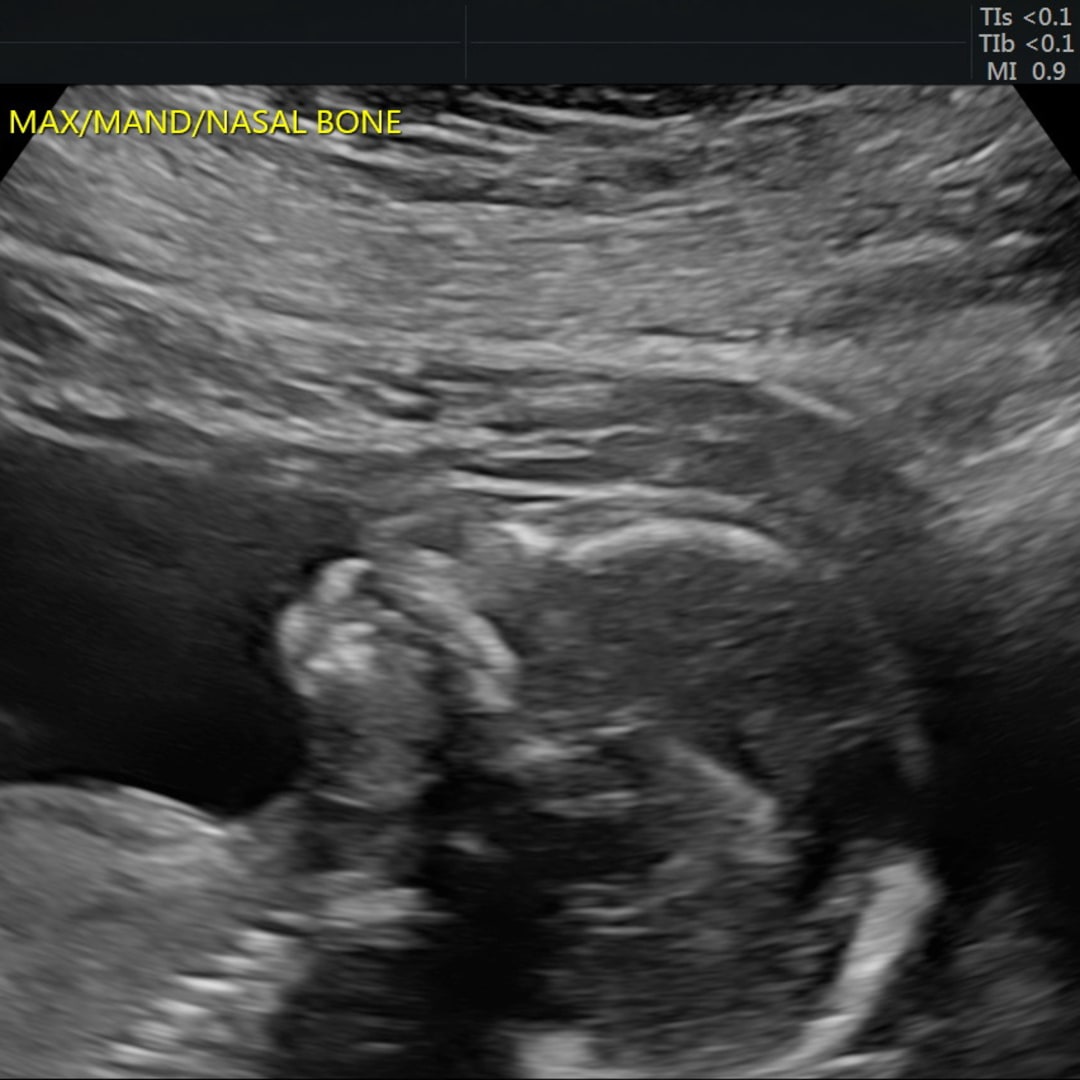 Photo shared by Brooke for their Babylist baby registry.