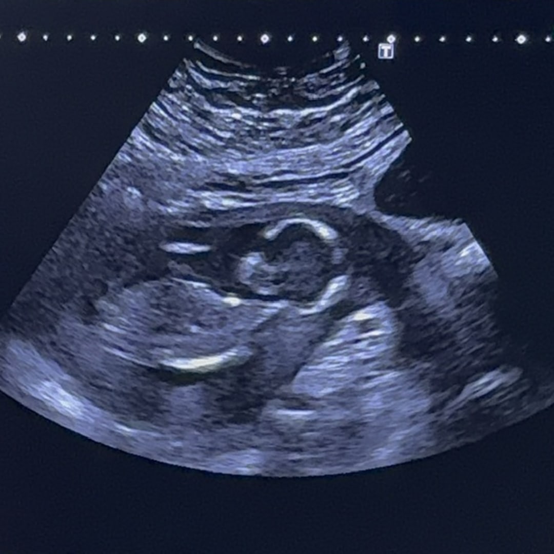 Photo shared by Angie for their Babylist baby registry.