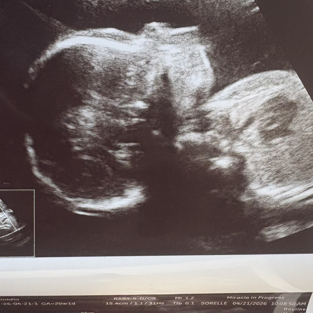 Photo shared by Amadia for their Babylist baby registry.