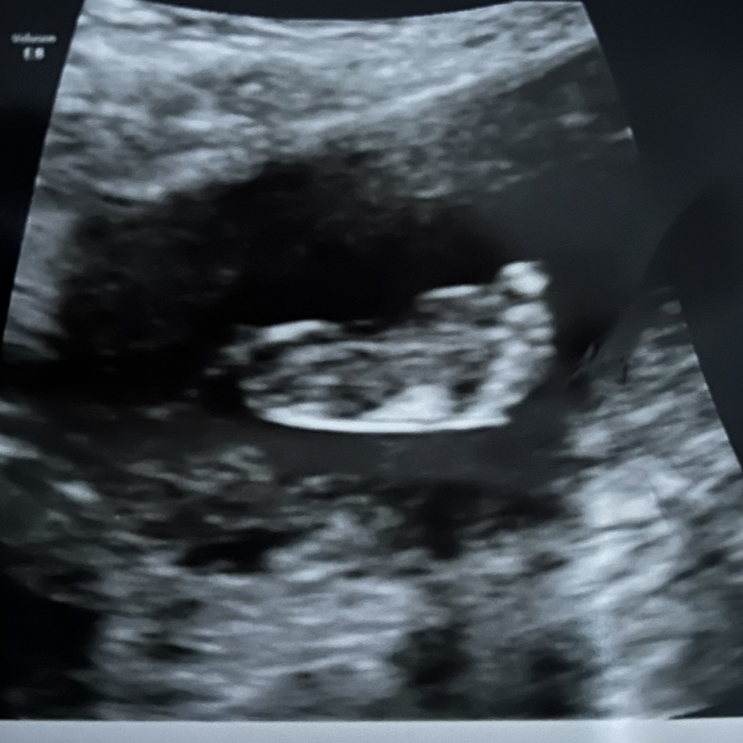 Photo shared by Alyssa for their Babylist baby registry.