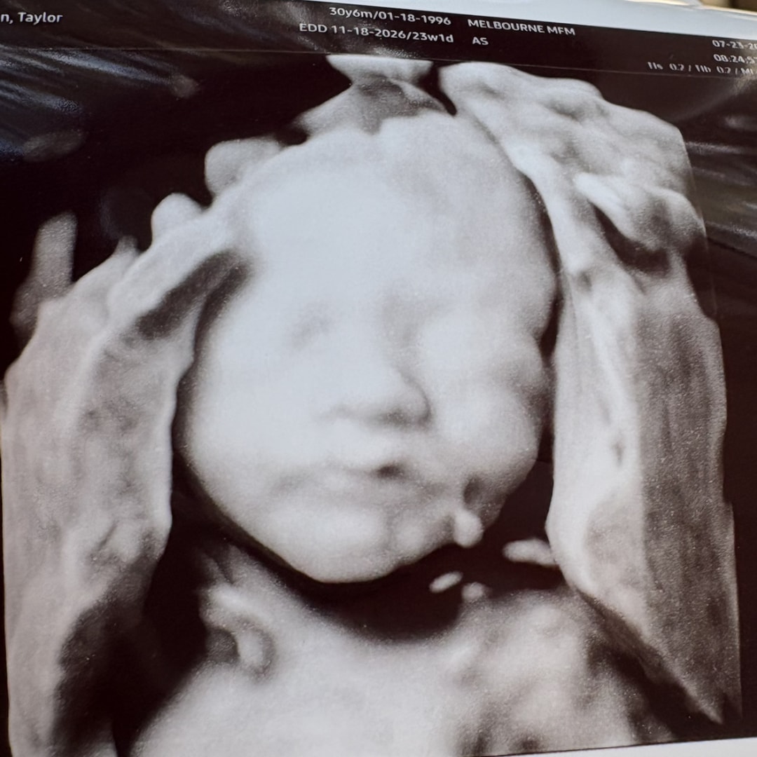 Photo shared by Taylor for their Babylist baby registry.
