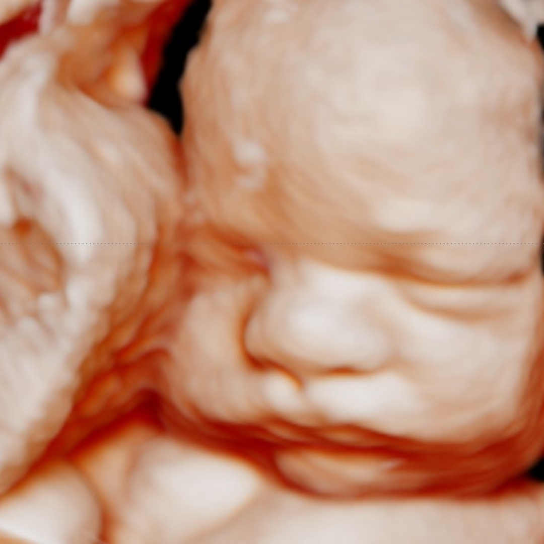 Photo shared by Allyah for their Babylist baby registry.