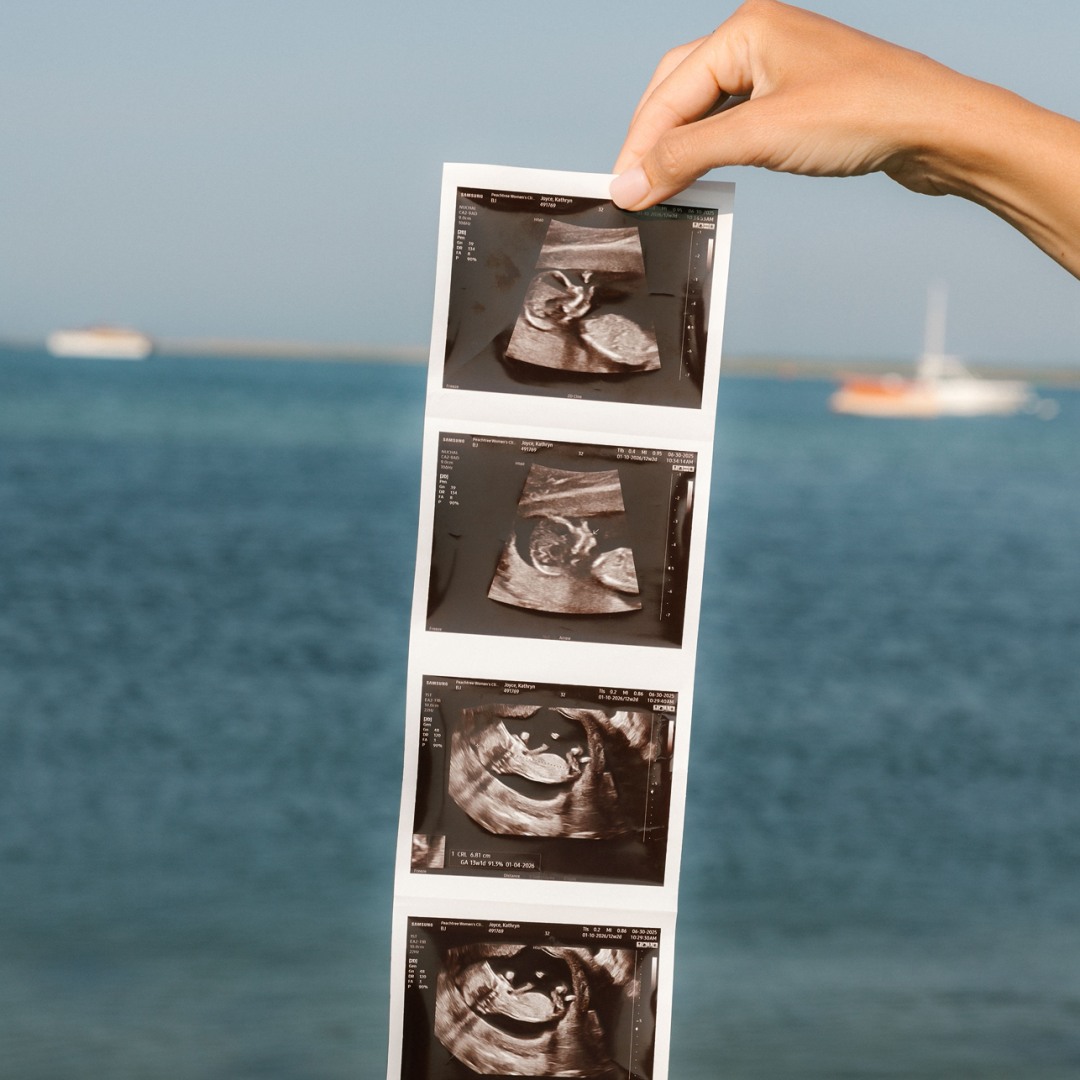 Photo shared by Katie for their Babylist baby registry.