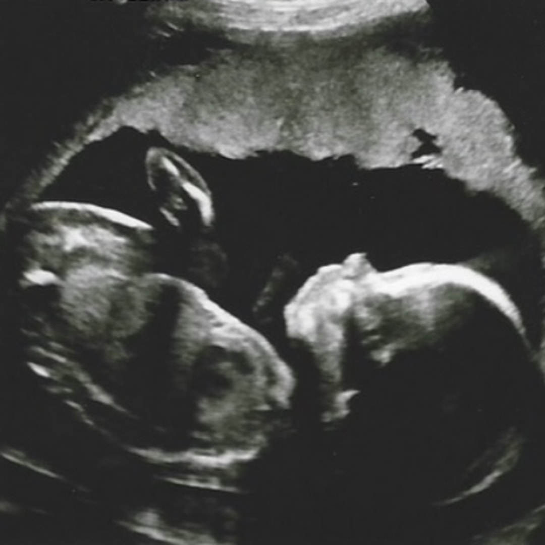 Photo shared by Rachel for their Babylist baby registry.