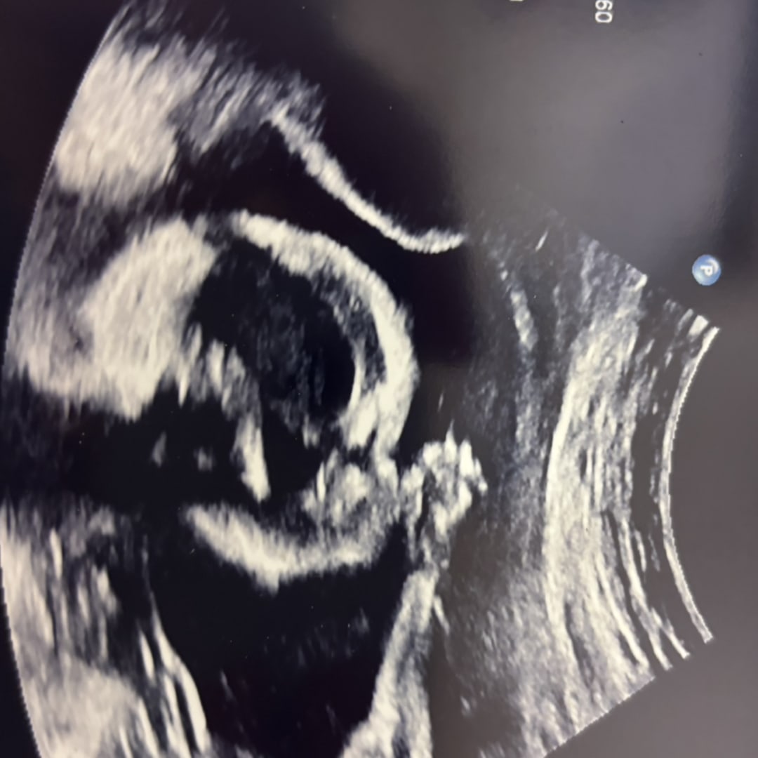 Photo shared by Kyrsten for their Babylist baby registry.