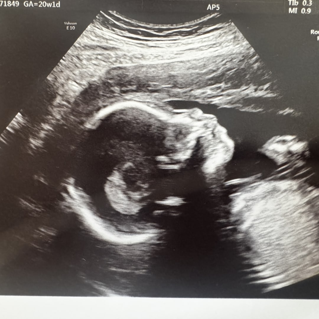 Photo shared by Julia for their Babylist baby registry.