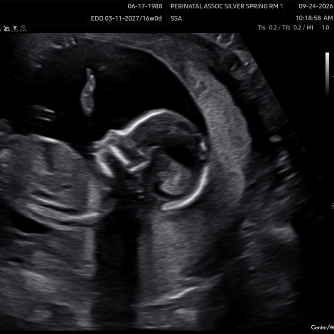 Photo shared by Ashley for their Babylist baby registry.