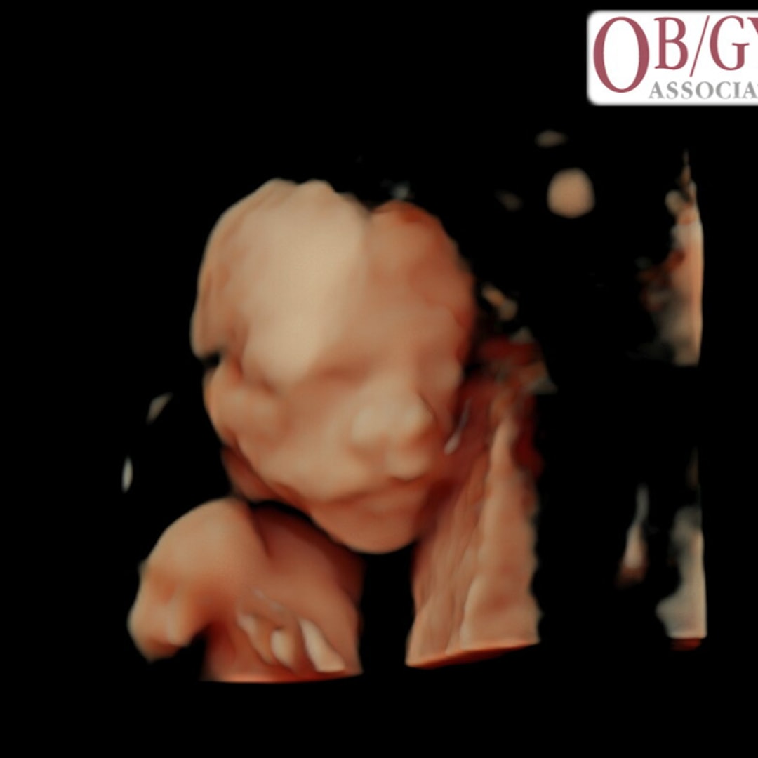 Photo shared by Rachel for their Babylist baby registry.