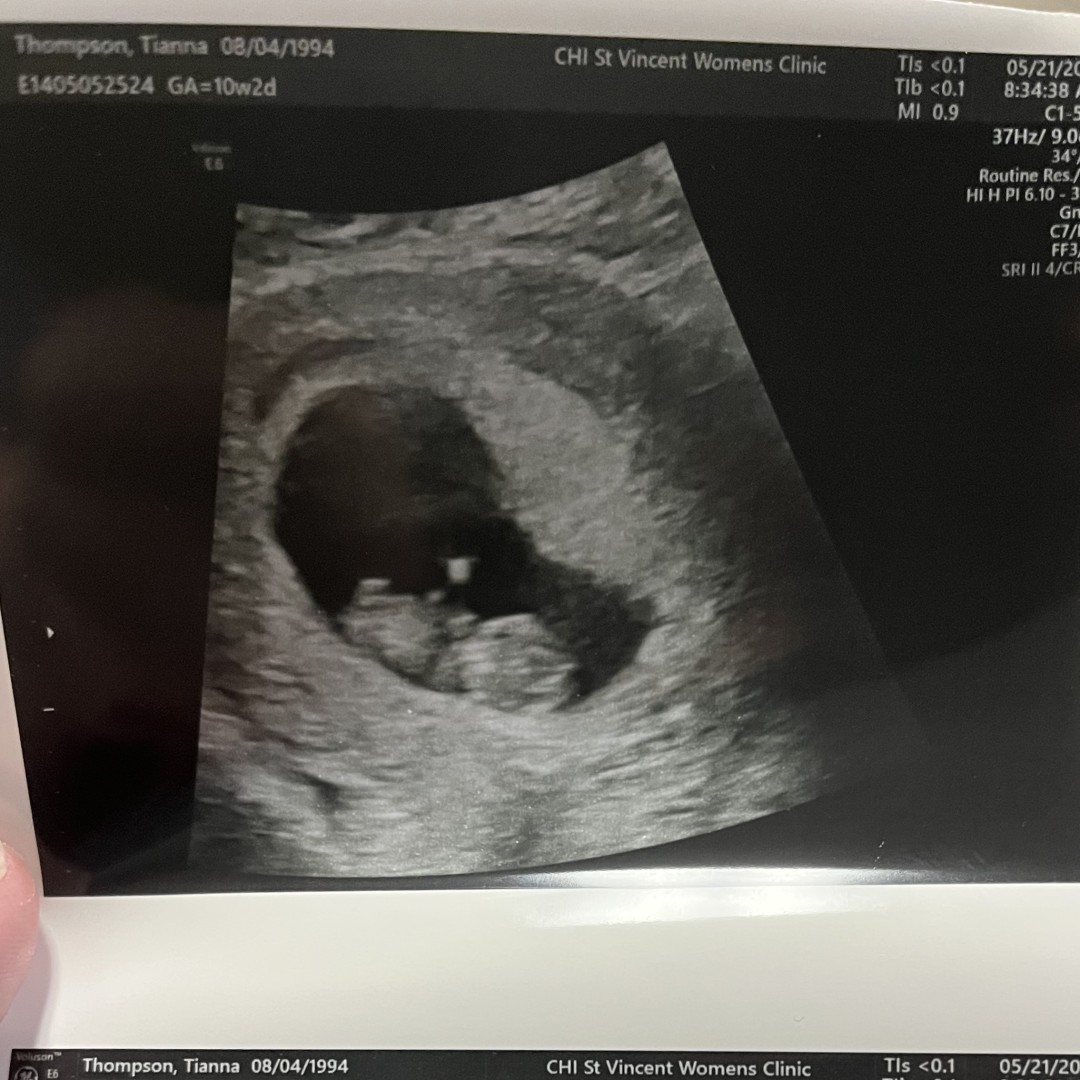 Photo shared by Tianna for their Babylist baby registry.