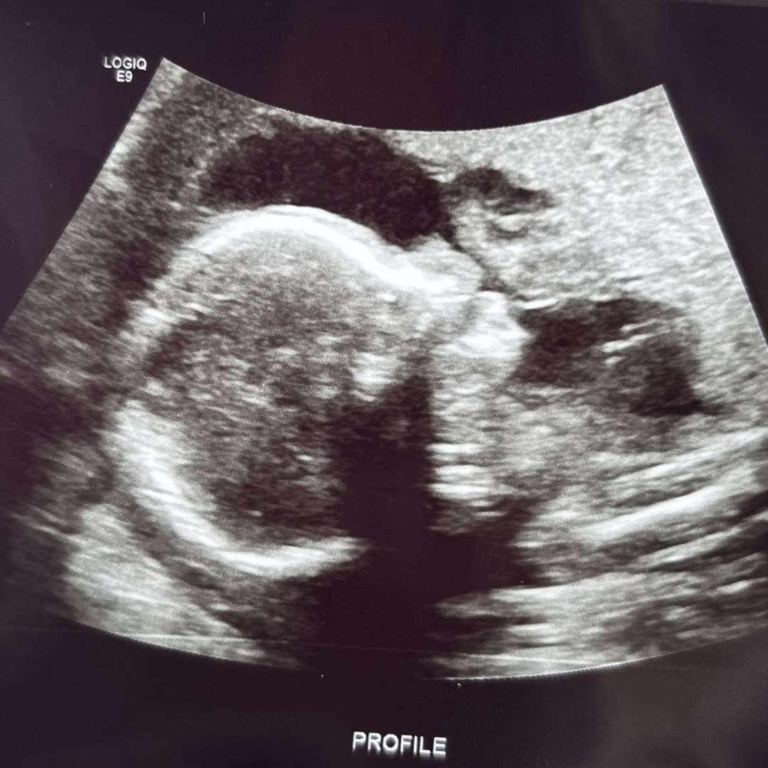 Photo shared by Chloe for their Babylist baby registry.