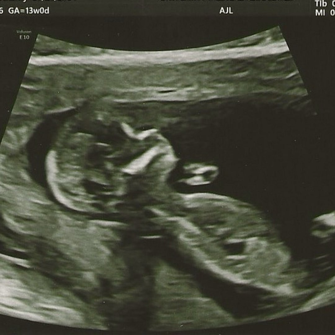 Photo shared by Delaney for their Babylist baby registry.