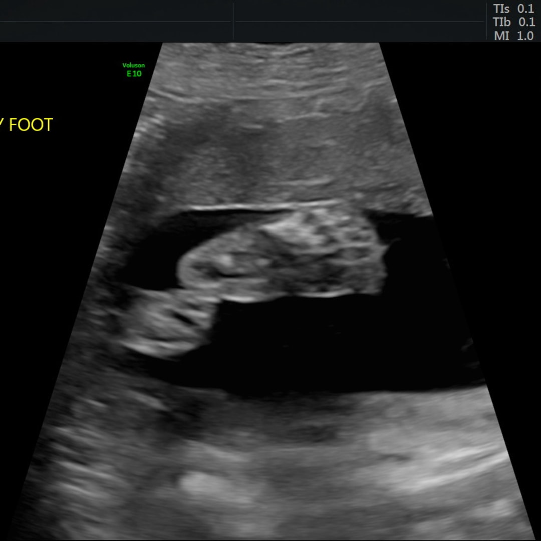 Photo shared by Akeylah for their Babylist baby registry.