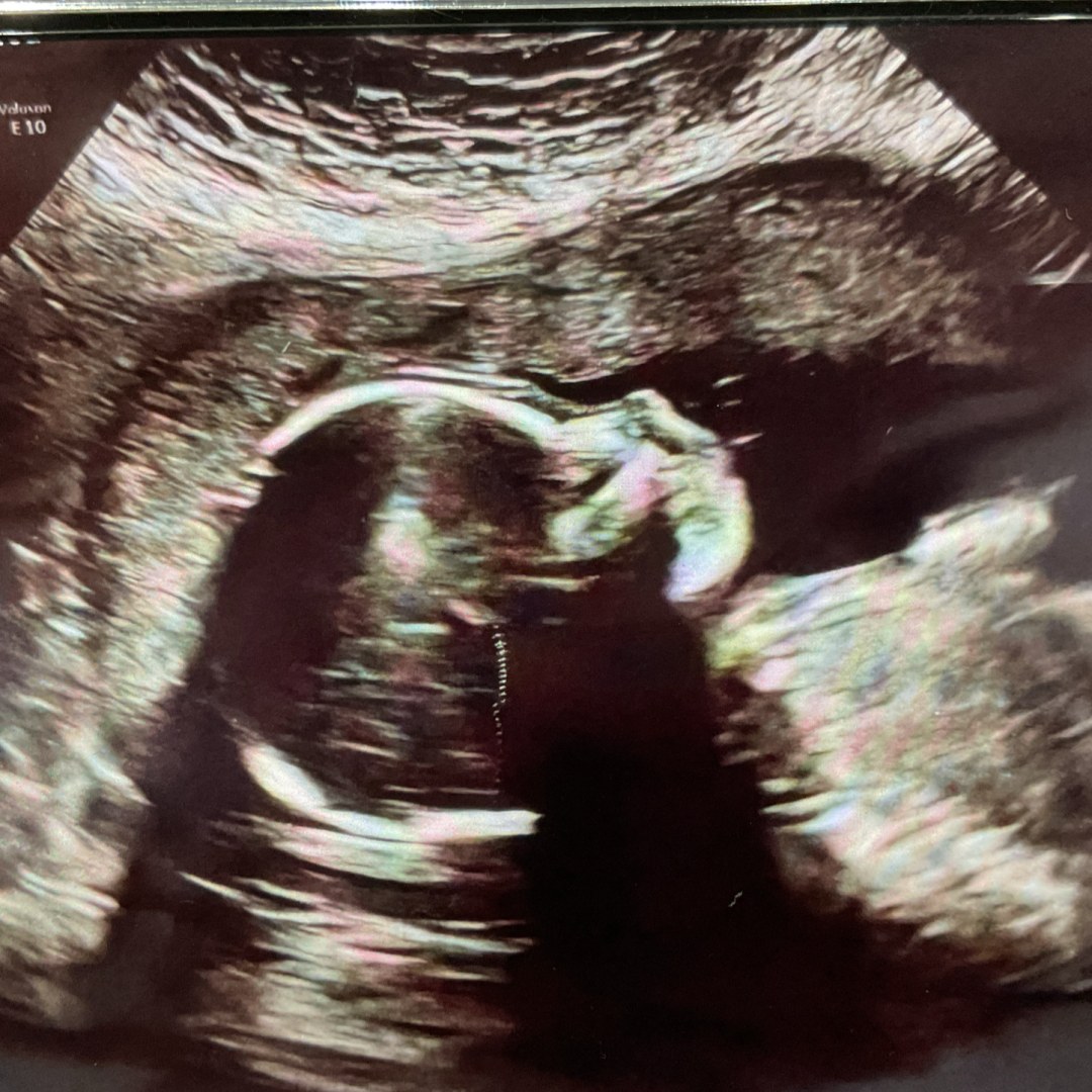 Photo shared by Jenna for their Babylist baby registry.