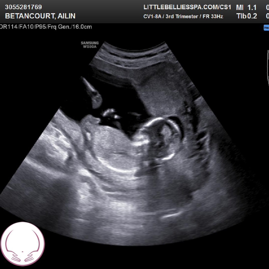 Photo shared by Ailin for their Babylist baby registry.