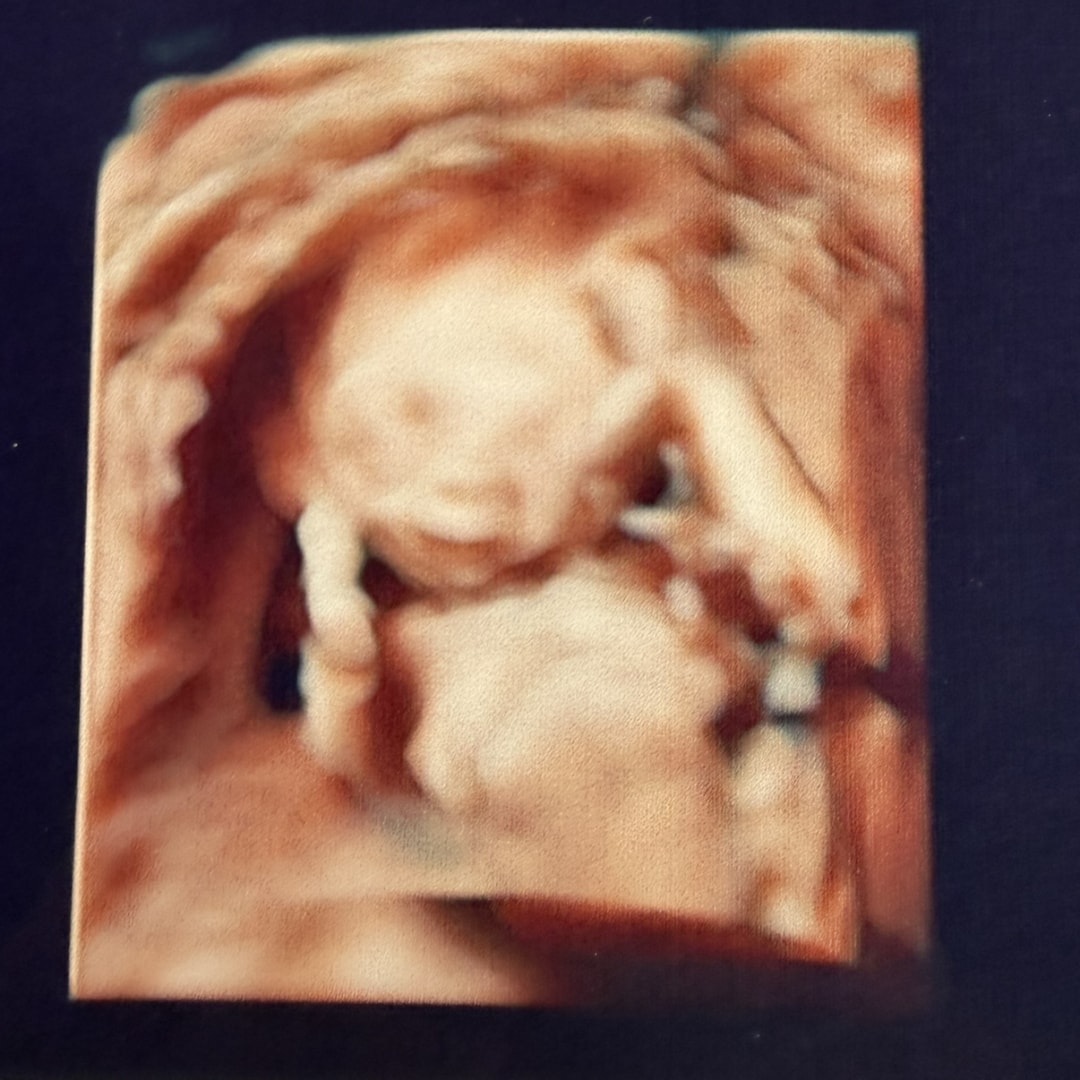 Photo shared by Tara for their Babylist baby registry.