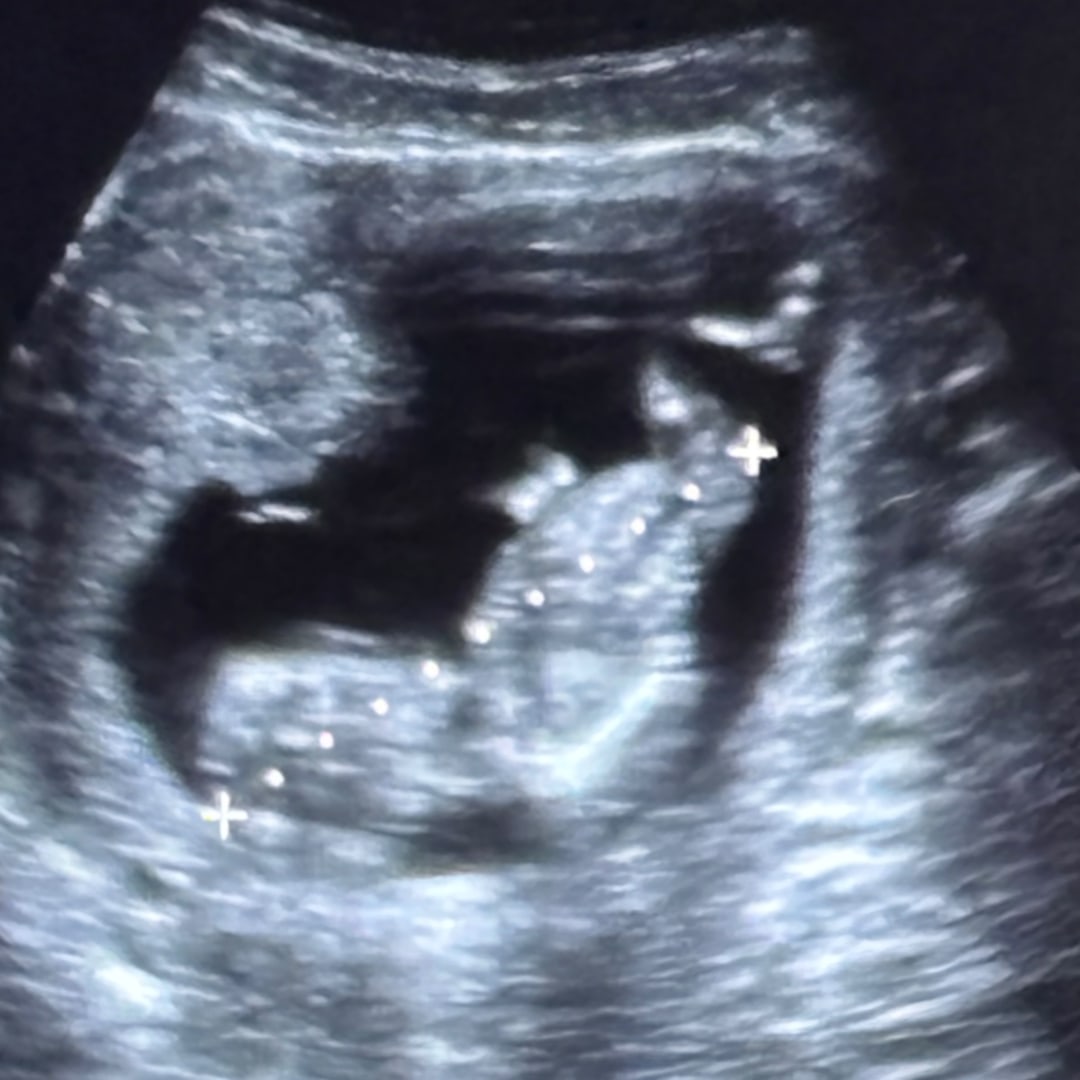 Photo shared by Giuliana for their Babylist baby registry.
