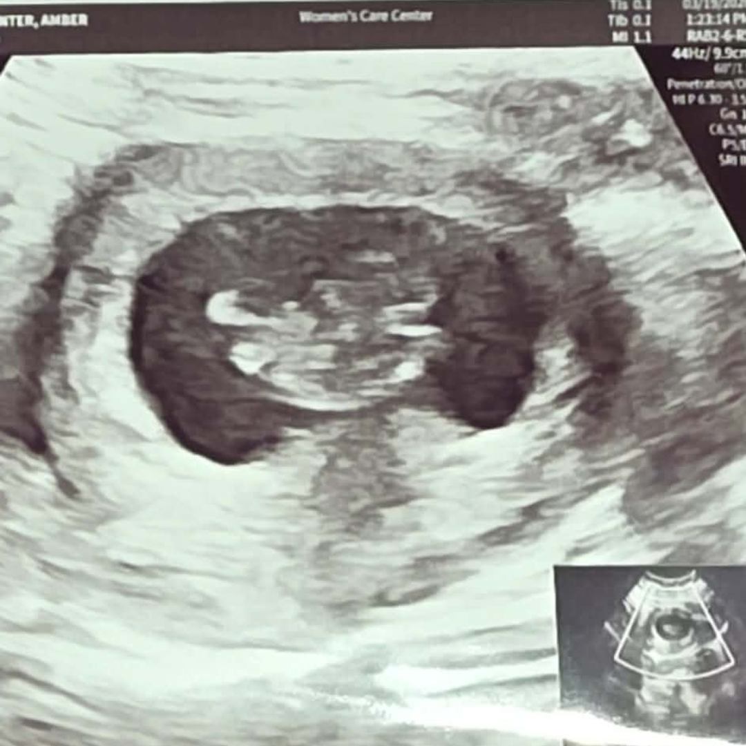 Photo shared by Amber for their Babylist baby registry.