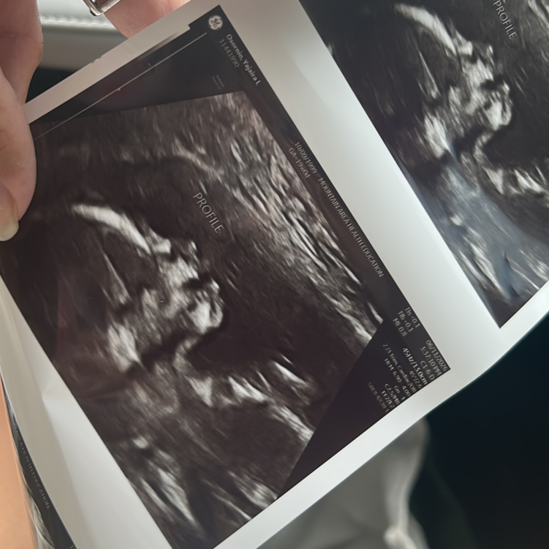 Photo shared by Yajaira for their Babylist baby registry.
