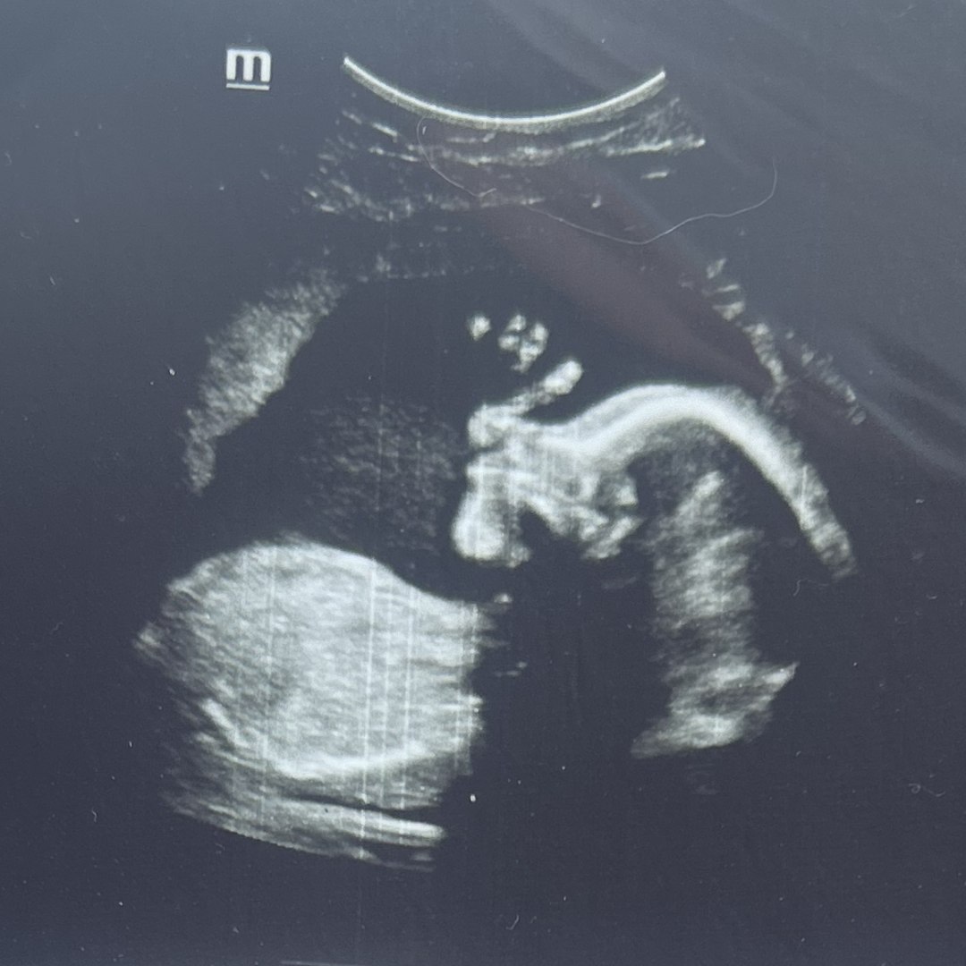 Photo shared by Gabriella for their Babylist baby registry.