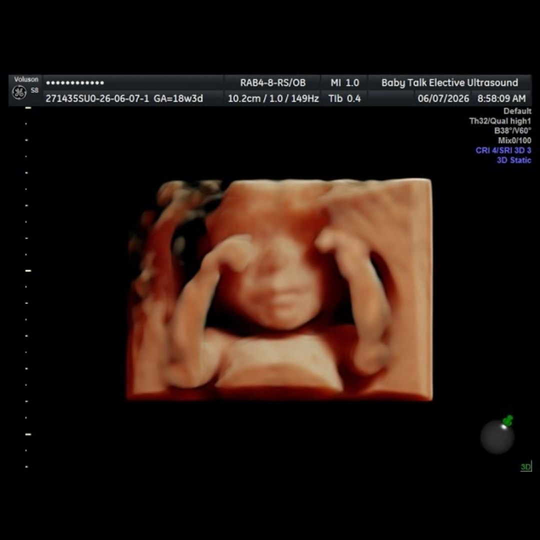 Photo shared by Hayley for their Babylist baby registry.