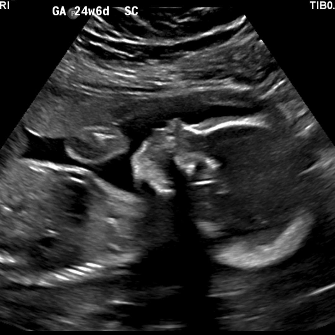 Photo shared by Katie for their Babylist baby registry.