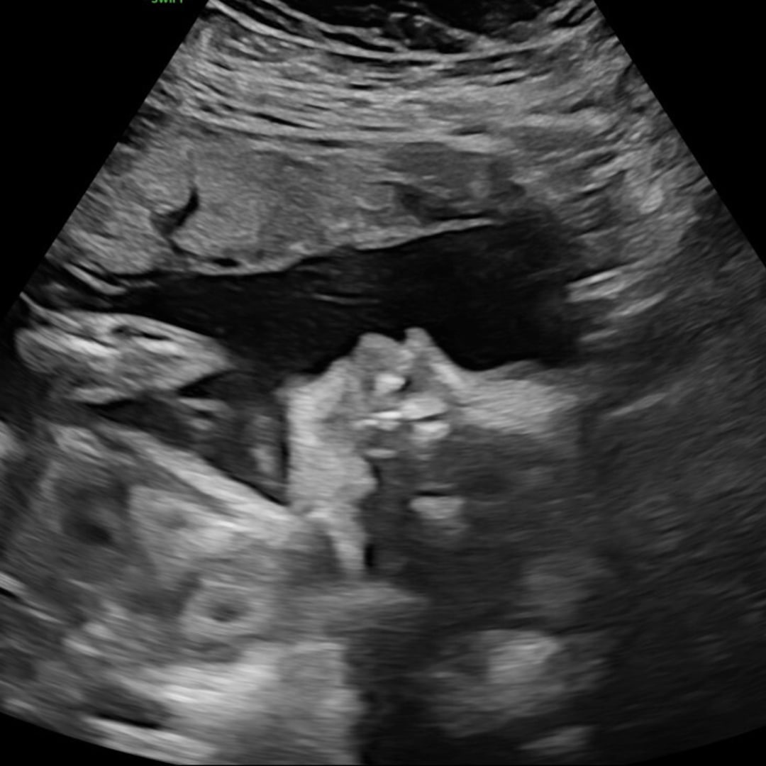 Photo shared by Brynn for their Babylist baby registry.