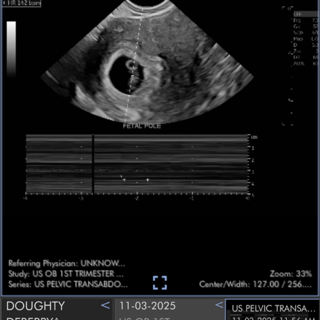 Photo shared by Samaria for their Babylist baby registry.