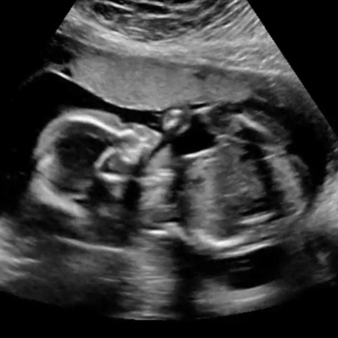 Photo shared by Kaitlin for their Babylist baby registry.